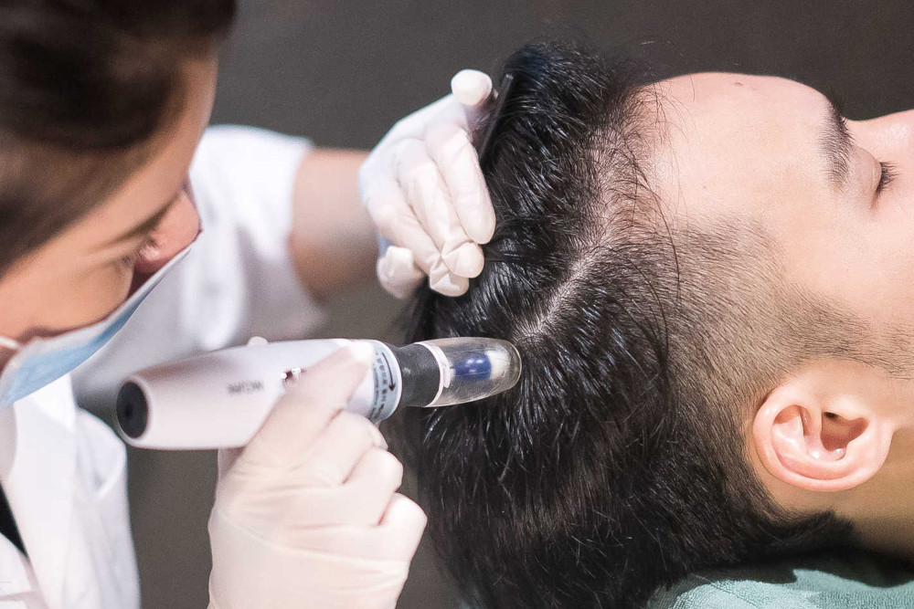 traitement perte de cheveux